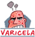 varicela
